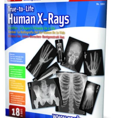human x-ray 2