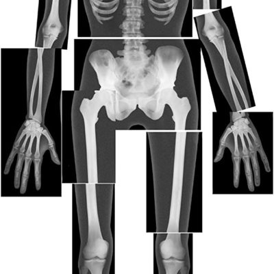 human x-ray